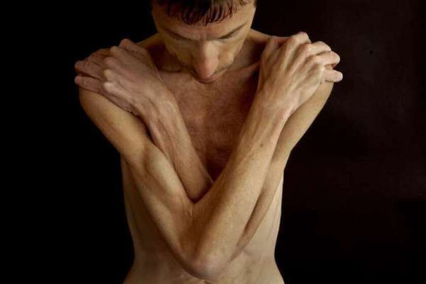 Anorexia nervosa and bulimia are debilitating and occur in 1% to 3% of women, less frequently among men.