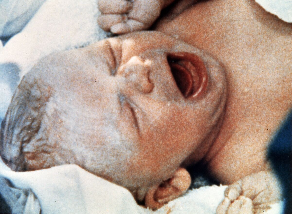A newborn baby cries