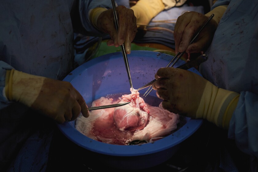 In this photo provided by NYU Langone Health, surgeons prepare a genetically modified pig heart for transplant into a recently deceased donor at NYU Langone Health on Wednesday, July 6, 2022, in New York. Experiments are raising new hope that pigs might one day help fill a shortage of donated organs -- at least, for people who need a new heart or kidney. (Joe Carrotta/NYU Langone Health via AP)