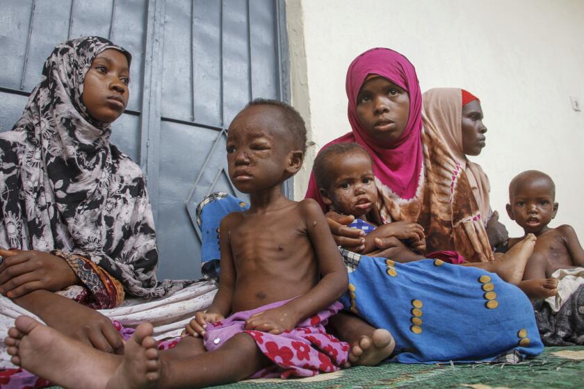 Somali children displaced by drought and showing symptoms of Kwashiorkor, a severe protein malnutrition causing swelling and skin lesions, sit with their mothers at a malnutrition stabilization center run by Action against Hunger, in Mogadishu, Somalia Sunday, June 5, 2022. Deaths have begun in the region's most parched drought in decades and previously unreported data show nearly 450 deaths this year at malnutrition treatment centers in Somalia alone. (AP Photo/Farah Abdi Warsameh)