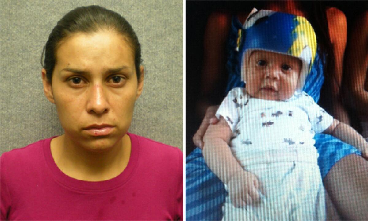 Side-by-side photos of an unsmiling woman and a baby in a protective helmet.