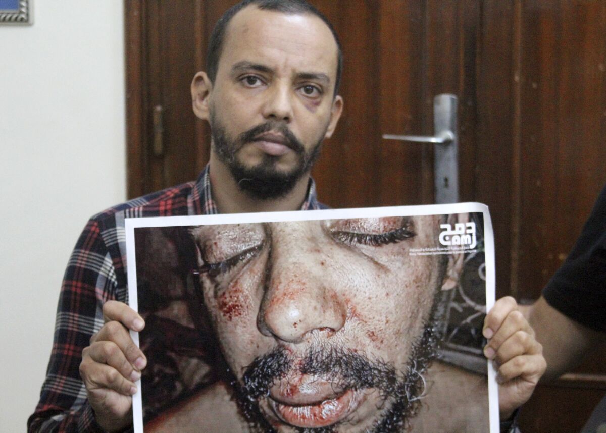 Tunisian prominent LGBTQ activist Badr Baabou holds a photograph of himself after he was beaten, during an interview with The Associated Press in Tunis, Wednesday, Oct. 27, 2021. Police violence is among a myriad of challenges facing LGBTQ individuals in Tunisia. Observers say that the recent assault of the high-profile LGBTQ activist is an indication that law enforcement are becoming more brazen in their targeting of LGBTQ individuals. (AP Photo/Hassene Dridi)