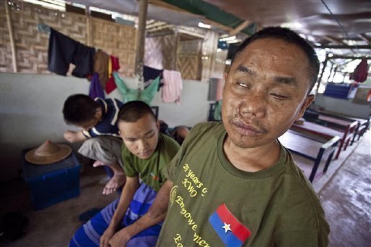 In this photo taken Tuesday, June 29, 2010, ethnic Karen refugee Pa Ko, 30, looks on from the Mae La Refugee Camp in western Thailand. Pa was injured in a landmine accident. The Karen, an ethnic minority people of about 4 million within Myanmar's 43 million, are being pushed by the military from their homes in western Myanmar to the border with Thailand almost daily. Human rights groups and aid workers call it "the hidden Darfur." (AP Photo/David Longstreath)
