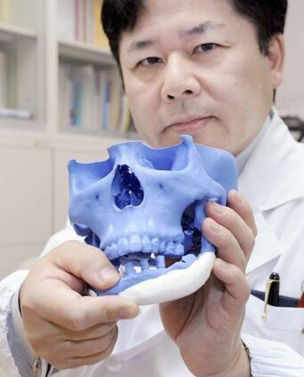 Tsuyoshi Takado, professor of the University of Tokyo Graduate School of Medicine, displays an artificial bone (white piece) which fits neatly into patient's skull, at his laboraotory in Tokyo on November 17, 2008. The custom-made bones are created from the calcium phosphate powder and a solidifying liquid which is more than 80 percent distilled water, using computer-assisted design. In the same way that an ink-jet printer propels droplets onto a piece of paper, a device squirts the liquid on a 0.1-millimetre-thick layer of the powder to form a desired shape.