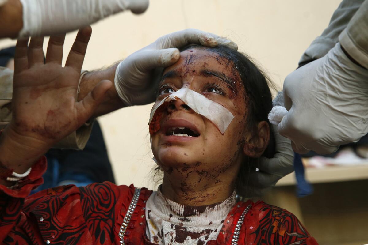 Menar Hassan, age 8, cries as doctors try to doctor her wounds after a suicide truck bombing. Her father died at the scene and had to be left in the rubble.