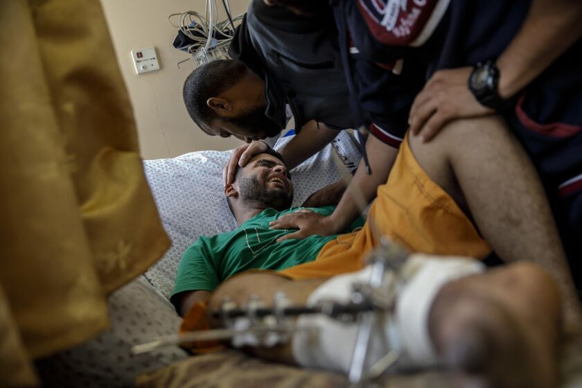 Baha Abu Ayash cries after being told by family members that his leg requires amputation at Shifa Hospital in Gaza City.