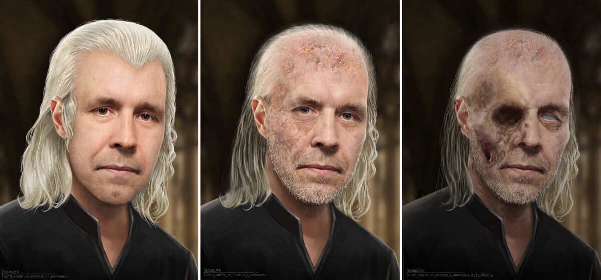 The progression of facial deterioration of a "House of the Dragon" character to the point where one eye is gone.