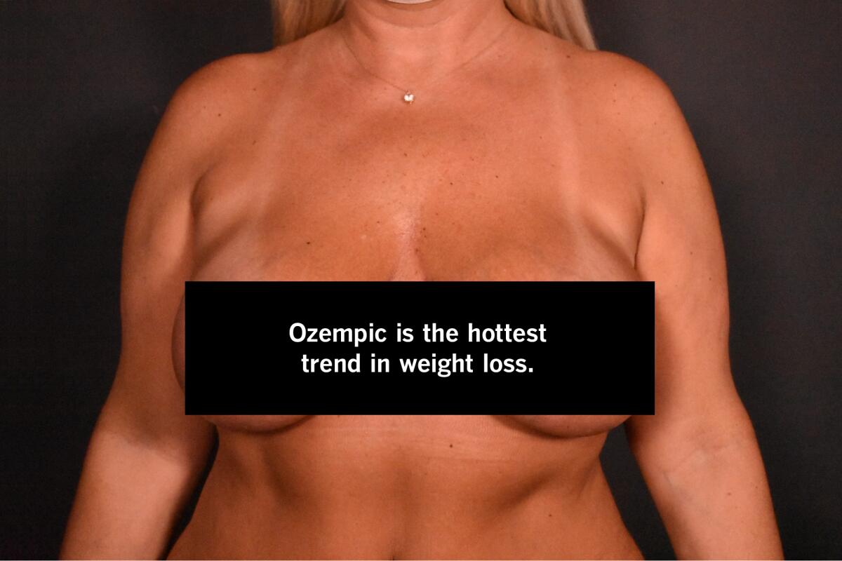 A woman topless and head cropped. A black bar covers her chest and reads, "Ozempic is the hottest trend in weight loss."