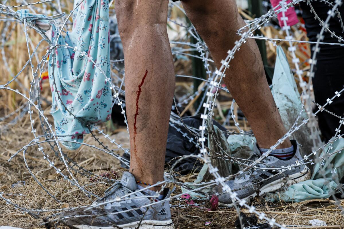 A man's legs bleed as he steps through coils of razor wire.