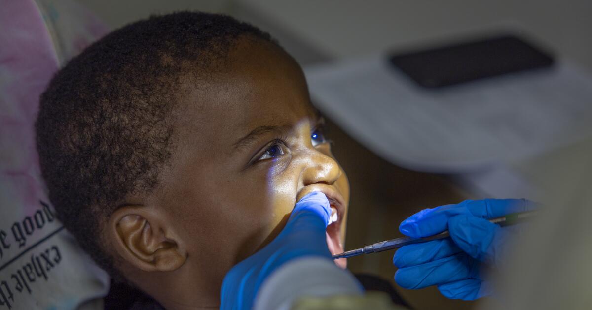 Tooth decay still plagues California kids nearly a decade after Medi-Cal promised change