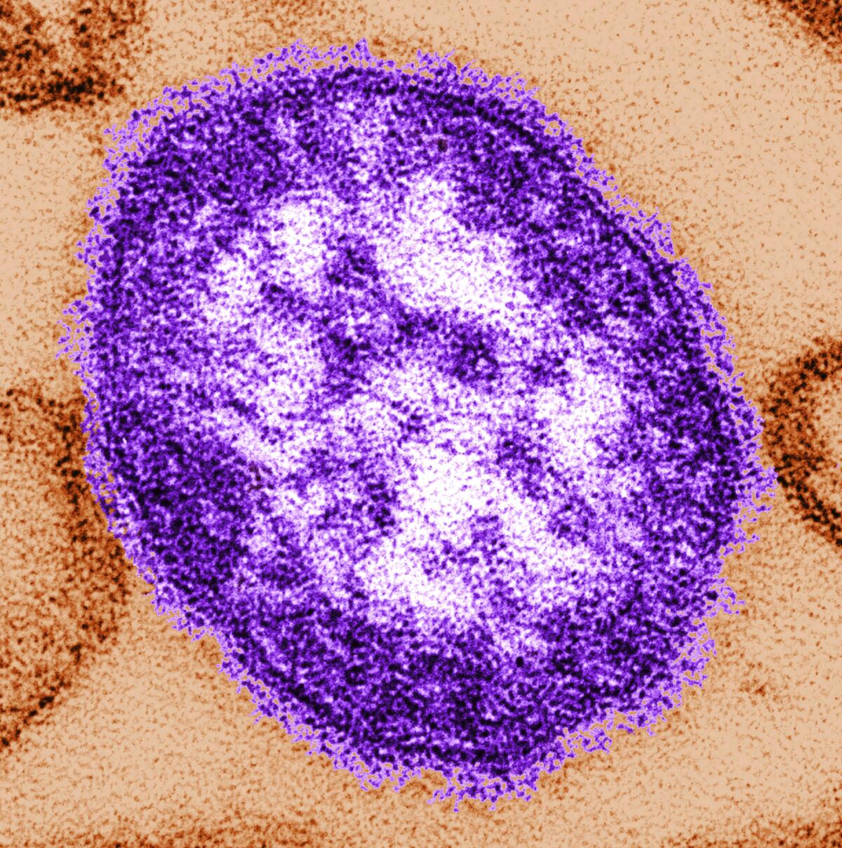 An electron microscope image of a measles virus particle.  