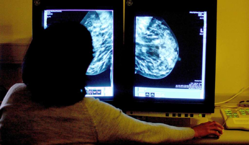 An expert on the value of cancer screening tests asks radiologists to stop attacking studies that question the value of screening mammograms.