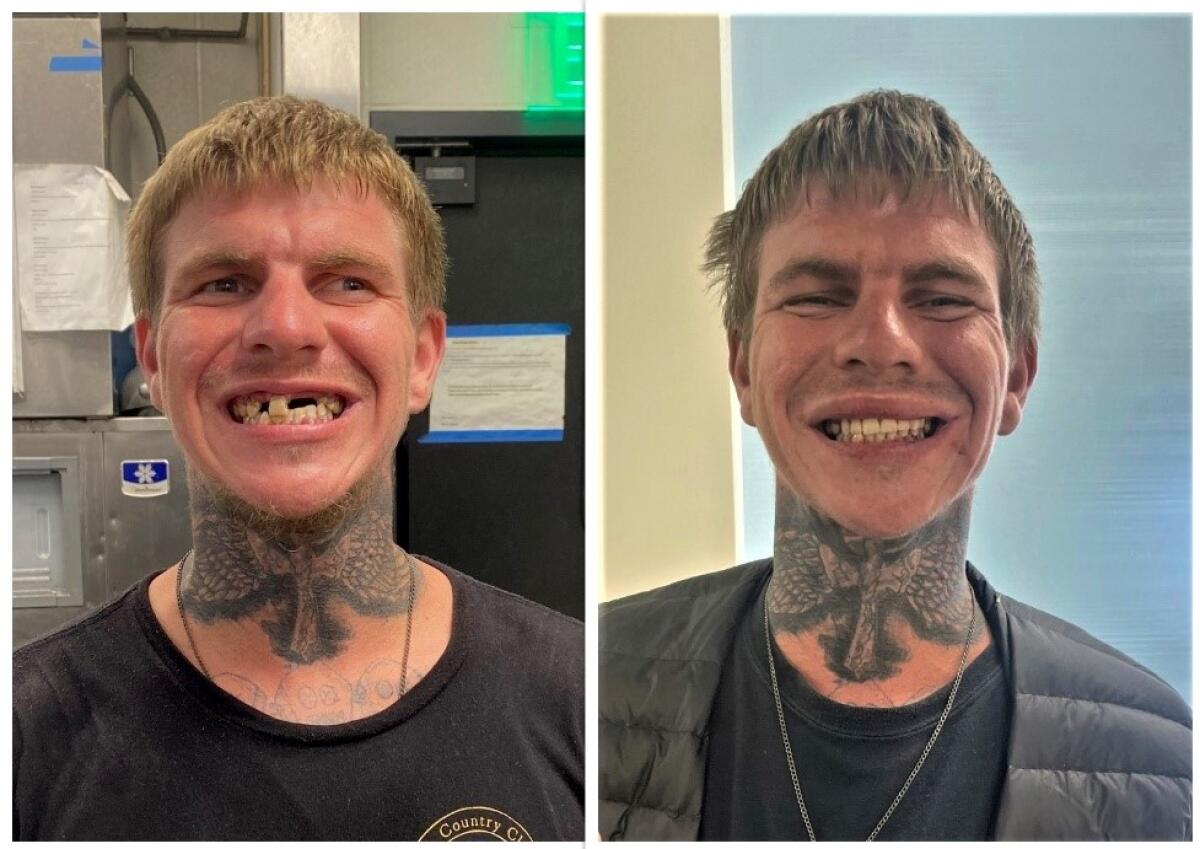 Costa Mesa resident David Feagin before and after receiving $13,448 in free dental care during Smile Generation Serve Day.