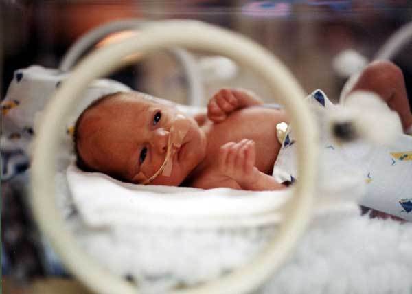 One of the McCaughey septuplets rests in an incubator after being born in 1997 -- nine weeks early. The birth brought to the forefront the use of fertility drugs and led to a Time Magazine cover story.