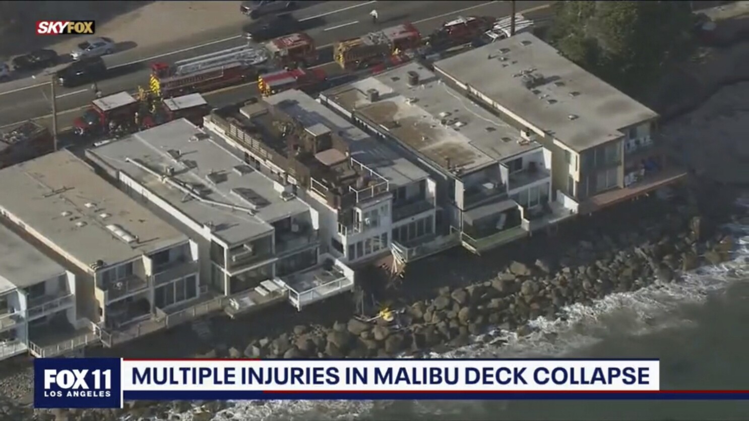 Malibu Investigating After 9 Hurt In Balcony Collapse The San Diego Union Tribune