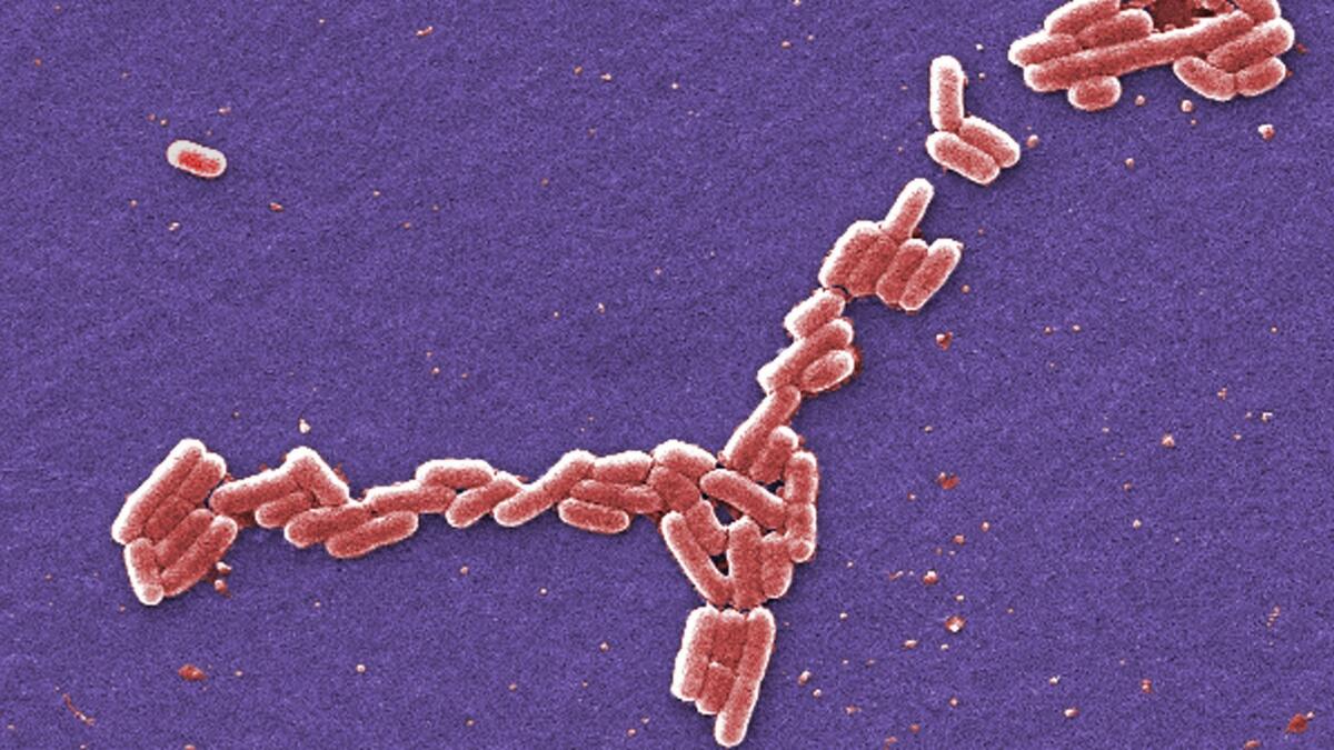 This colorized 2006 scanning electron microscope image made available by the Centers for Disease Control and Prevention shows E. coli bacteria of the O157:H7 strain that produces a powerful toxin that can cause illness.