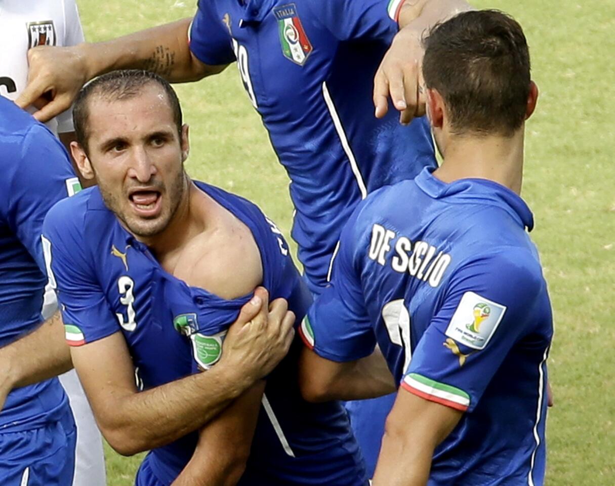 Italy's Giorgio Chiellini shows his teammates the bite marks on his shoulder after Uruguay's Luis Suarez apparently bit him during the group D World Cup soccer match between Italy and Uruguay.