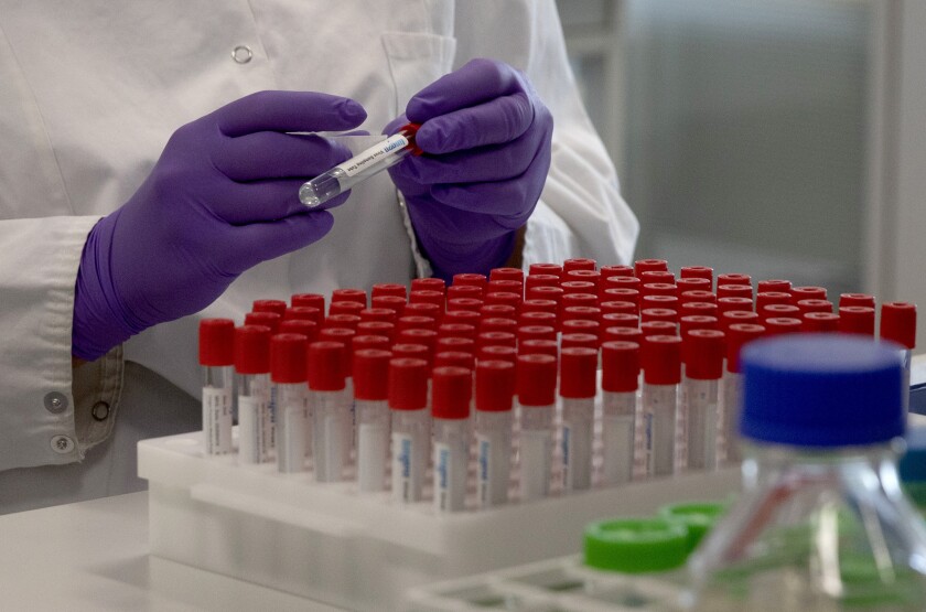 A lab technician puts a label on a test tube during research on the novel coronavirus.