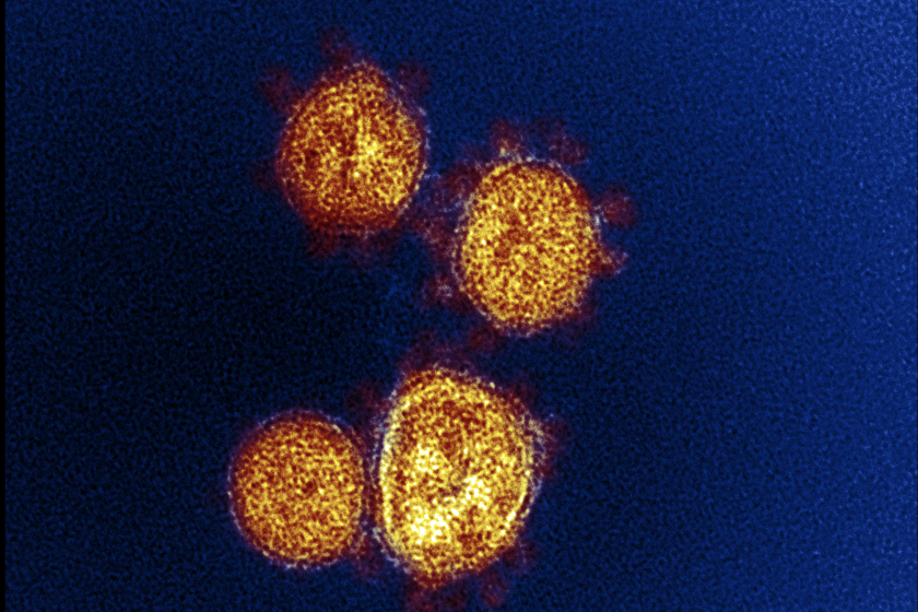 Coronavirus particles emerge from the surface of cells cultured in the lab.