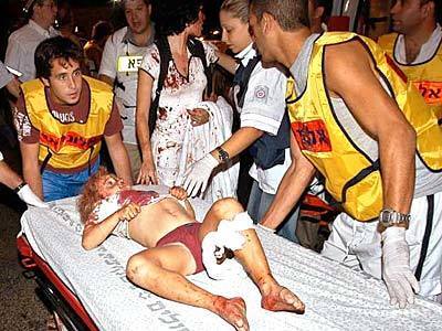 An injured child is taken to a hospital following a blast in Taba.