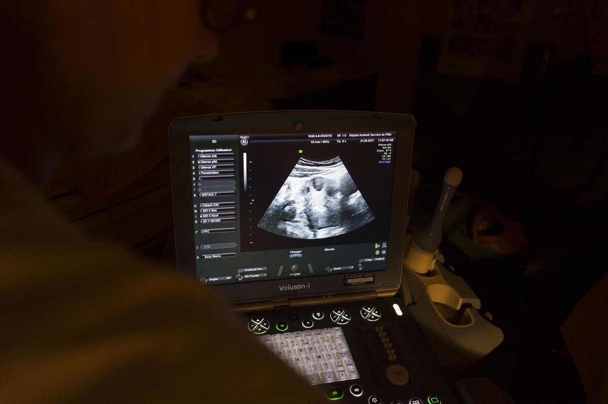 An embryo transfer under ultrasound control.
