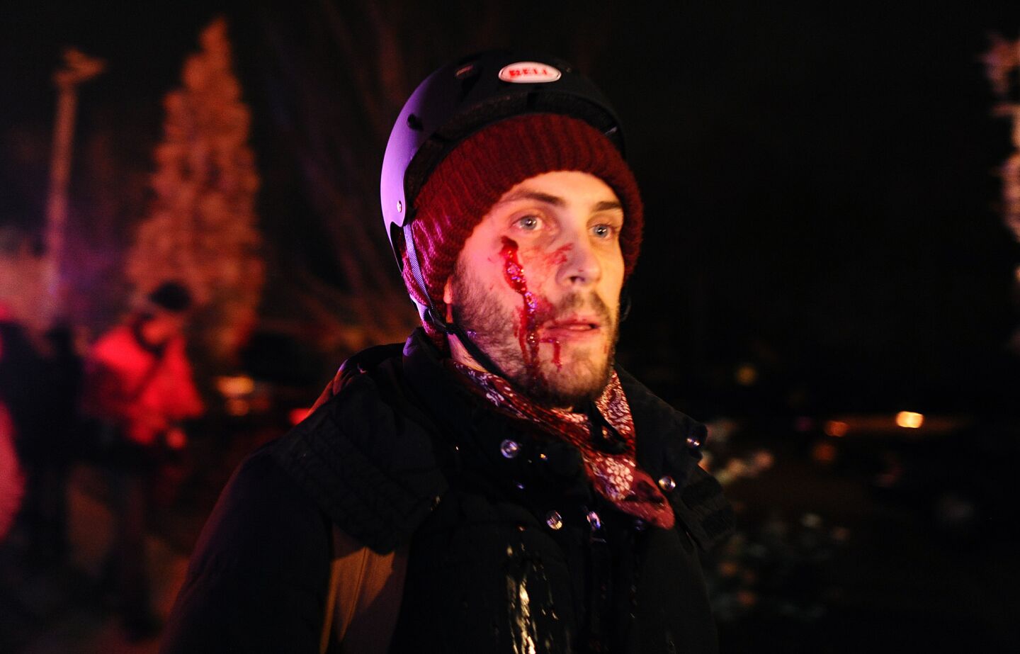 A journalist who was injured when rocks were thrown by protesters after the grand jury decision in Ferguson, Mo.