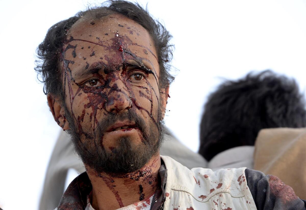 A wounded man walks at the site of an attack involving truck bombs in Afghanistan's Ghazni province on Sept. 4.