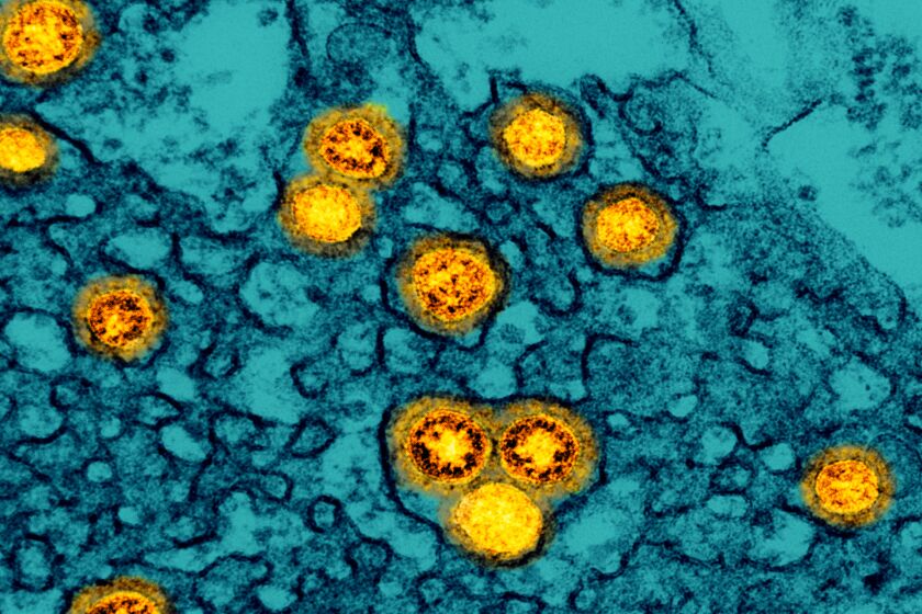 Transmission electron micrograph of SARS-CoV-2 Omicron virus particles replicating within the cytoplasm of an infected cell.