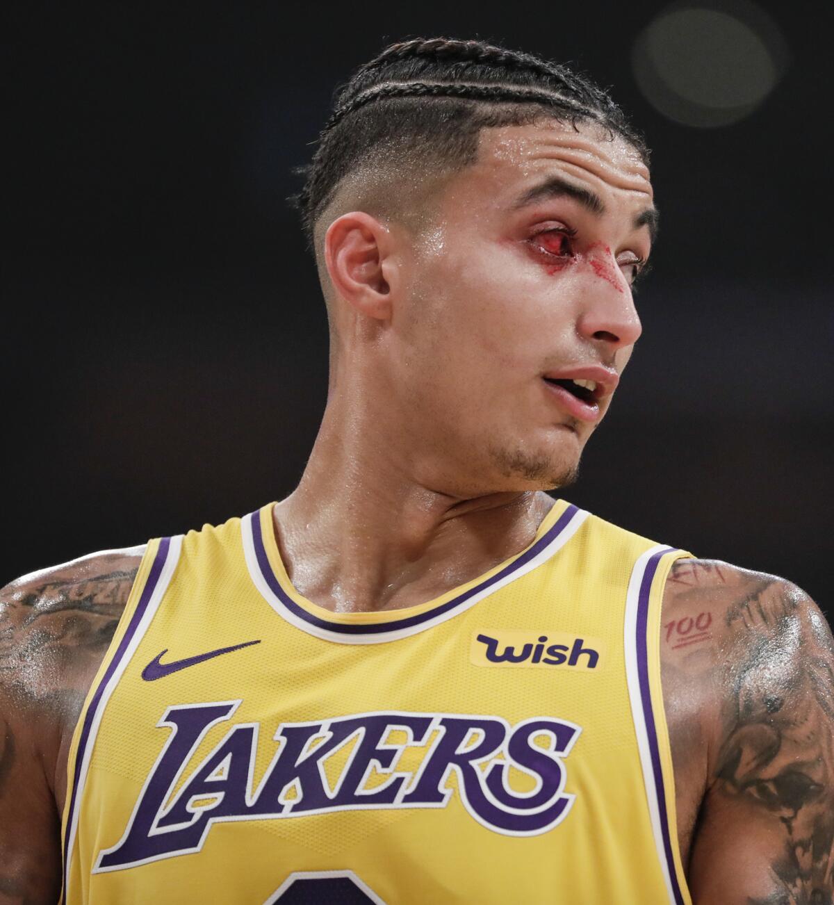 Lakers forward Kyle Kuzma leaves the court with a bloodied right eye during first half against the Thunder on Tuesday at Staples Center.