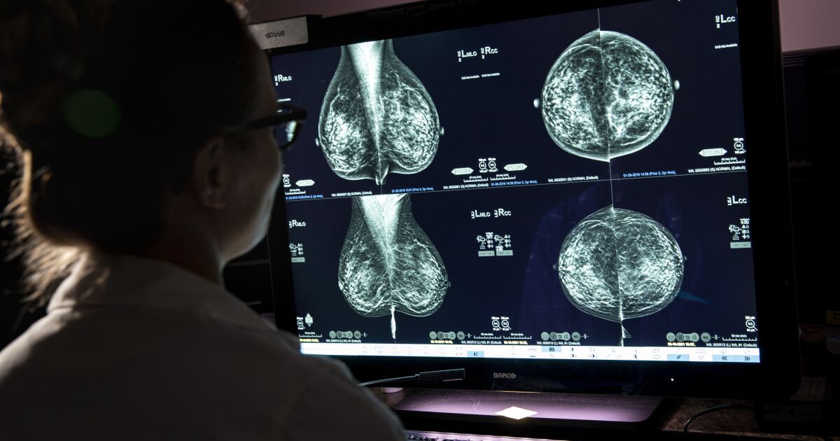 Mamogram tartışmasını ateşleyen uzman paneli şimdi testlerin 40 yaşında başlaması gerektiğini söylüyor