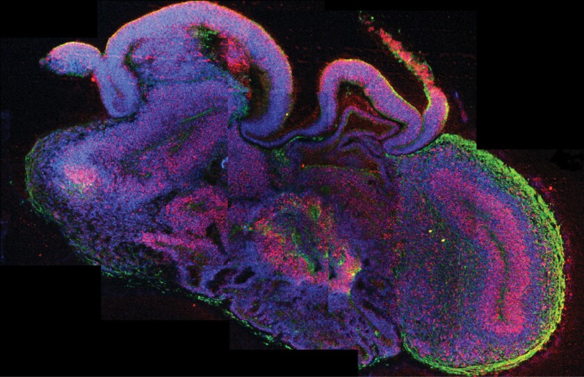 Using stem cells, scientists have grown human "brain organoids" that demonstrate development of a number of brain regions. In this cross-section of an entire organoid, neural stem cells are red and neurons are green.