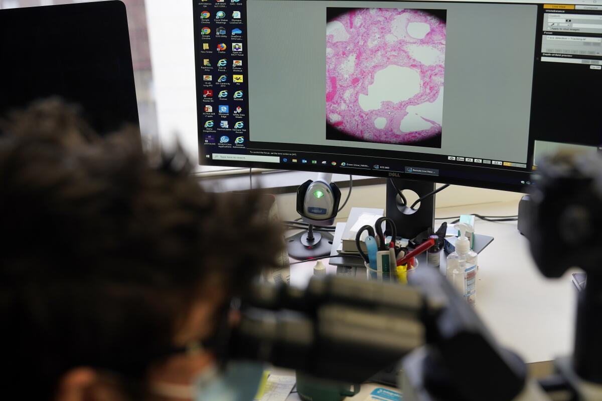 Pink tissue shown on a microscopic slide image on a computer screen