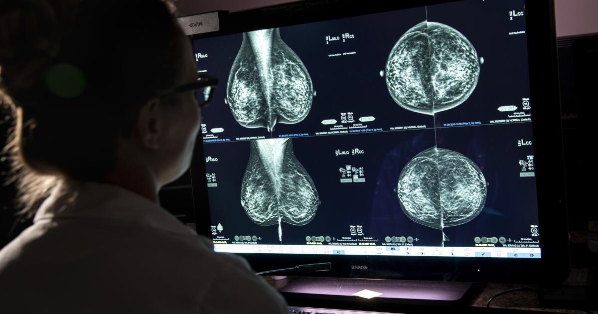 How often should you get a mammogram? It depends on whether you