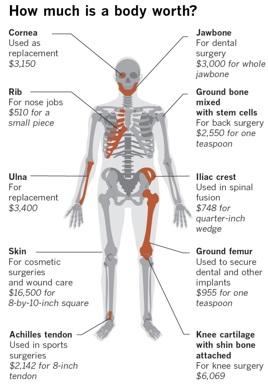 Least Rotted Body In the rush to harvest body parts, death investigations have been ...