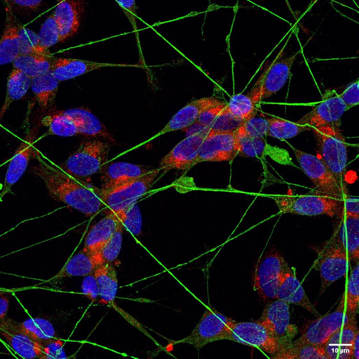 A group of neurons (blue) and the dendrites that connect them (green). The coronavirus' ACE2 receptor is in red.