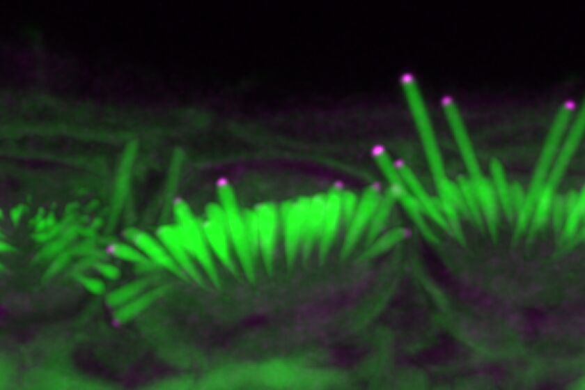 Stereocilia (green) of the inner ear, which transduce sound, are shown treated with the protein EPS8 (magenta) in mice.