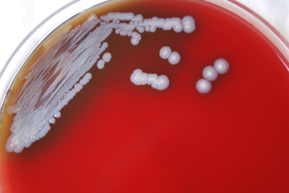A petri plate containing multiple colonies of Gram-negative Burkholderia pseudomallei bacteria.