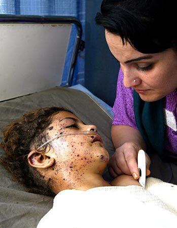 Kurdish child in Irbil hospital