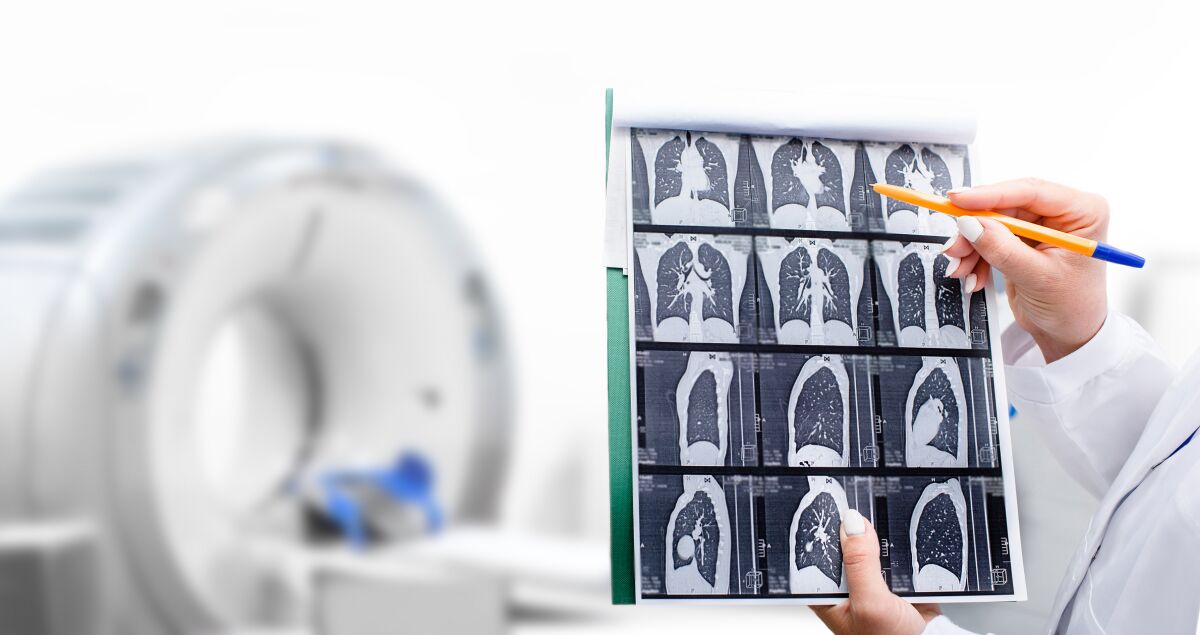 Radiologist showing tomography scan of a patient's lungs over of CT machine.