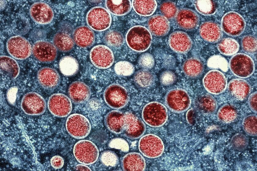 FILE - This image provided by the National Institute of Allergy and Infectious Diseases (NIAID) shows a colorized transmission electron micrograph of monkeypox particles (red) found within an infected cell (blue), cultured in the laboratory that was captured and color-enhanced at the NIAID Integrated Research Facility (IRF) in Fort Detrick, Md. On Friday, Aug. 12, 2022, The Associated Press reported on stories circulating online incorrectly claiming that monkeypox hasn't been detected in Georgia drinking water. The July 26 Atlanta-area news broadcast broadcast is being mischaracterized online to push the false claim that monkeypox has been found in residents’ tap water. (NIAID via AP)