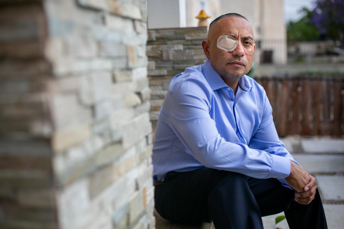 A man with a bandage over his right eye sits in front of a home.