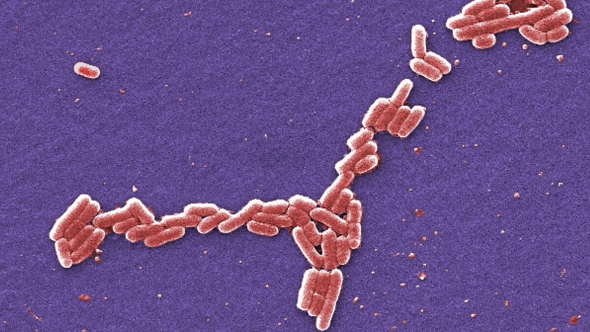This colorized 2006 scanning electron microscope image made available by the Centers for Disease Control and Prevention shows E. coli bacteria of the O157:H7 strain that produces a powerful toxin that can cause illness.