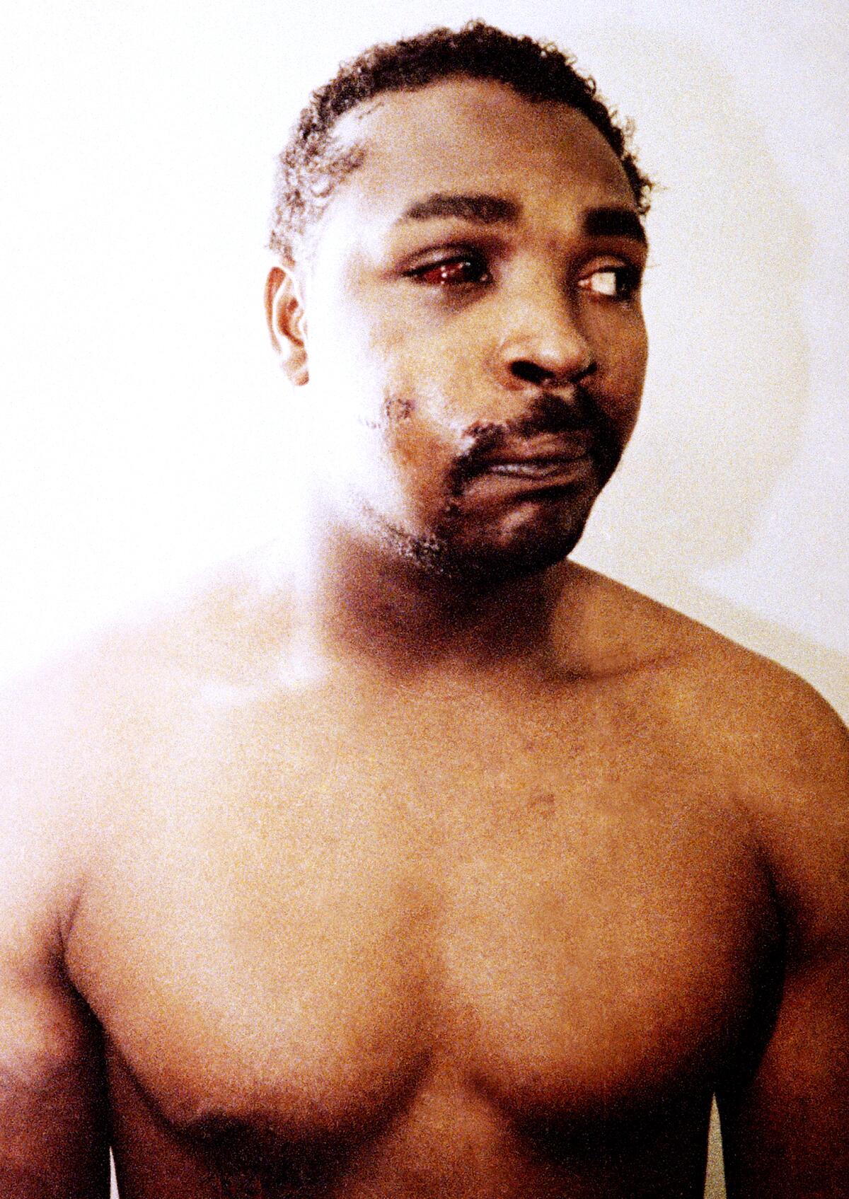 This file photo of Rodney King was taken three days after his videotaped beating