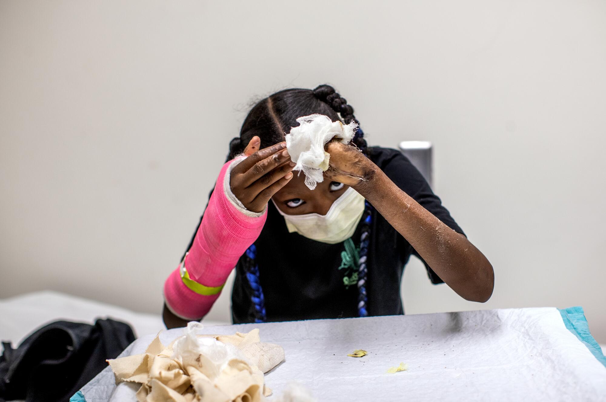 La'Veyah Mosley, 12, of Los Angeles looks at the damage to her left hand during a doctors appointment
